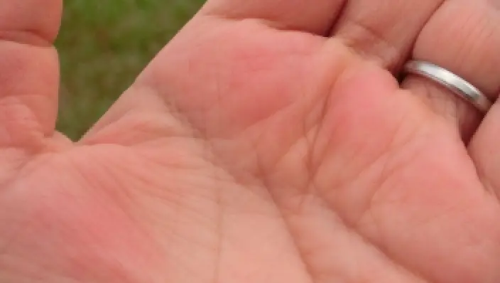 生命線の始点が鎖